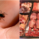 Illustration for article titled This tick’s bite causes red meat allergies—and it’s spreading